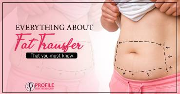 Everything About Fat Transfer That You must Know