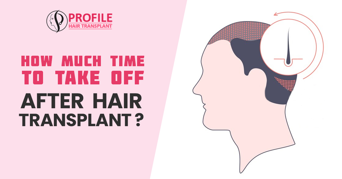 How Much Time to Take off after Hair Transplant?
