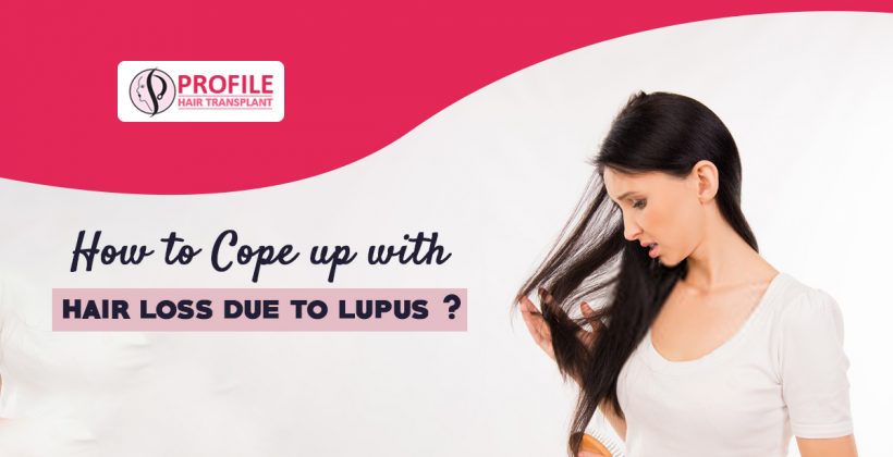 How to Cope up with hair loss due to lupus?