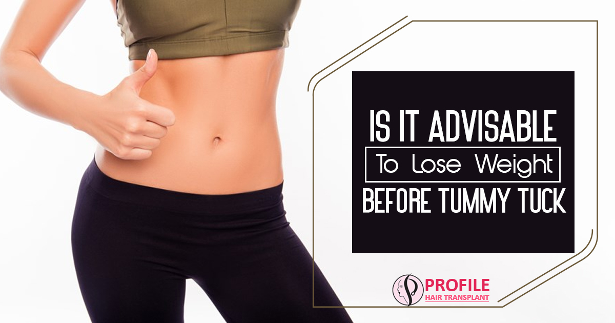 Is it advisable to lose weight before tummy tuck?