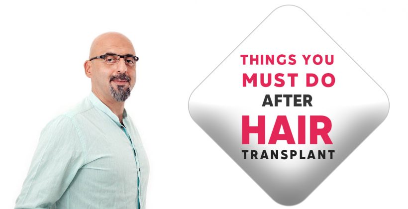 Things You Must Do After hair transplant