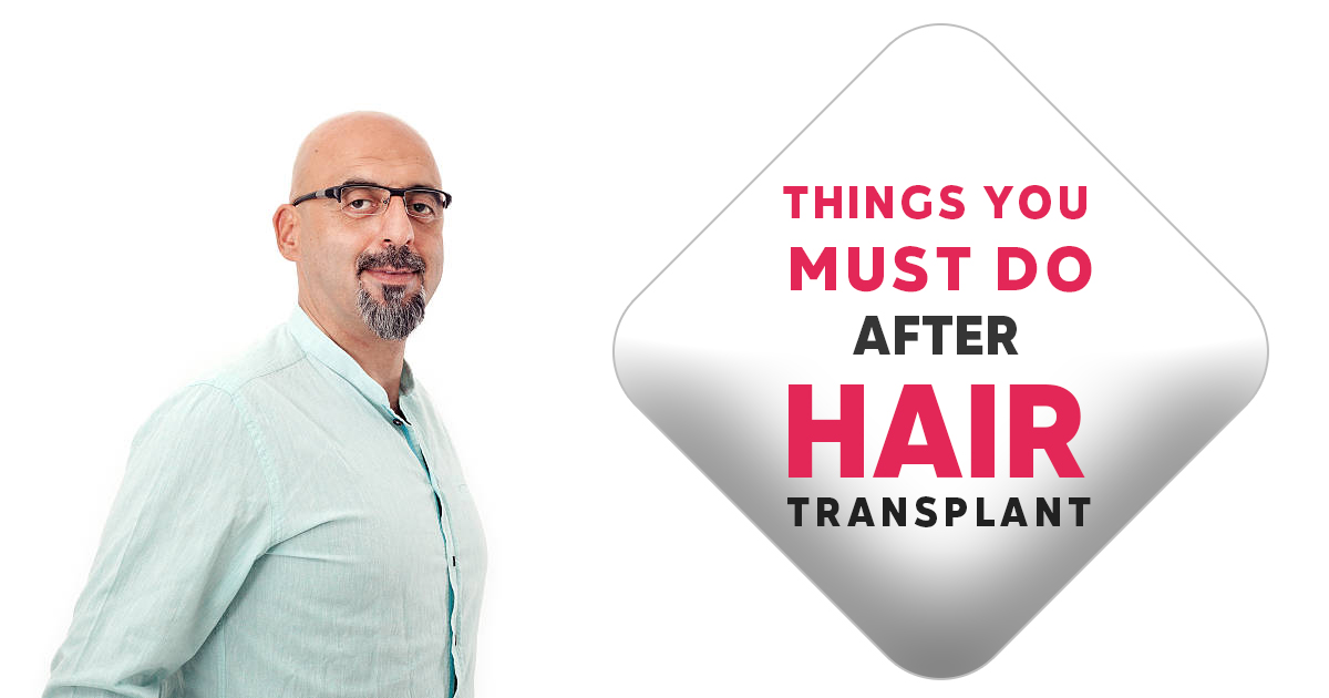 Things You Must Do After hair transplant