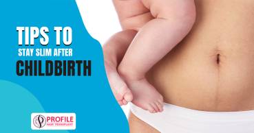 Tips to Stay Slim After Childbirth