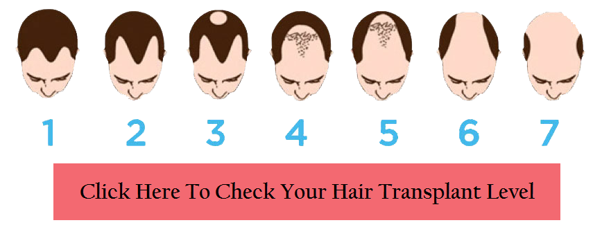 Check Your Hair transplant Level