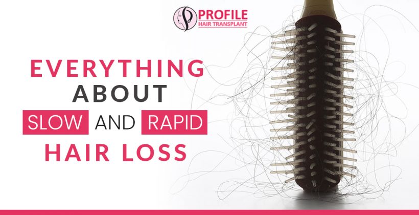 Everything about Slow and Rapid Hair Loss