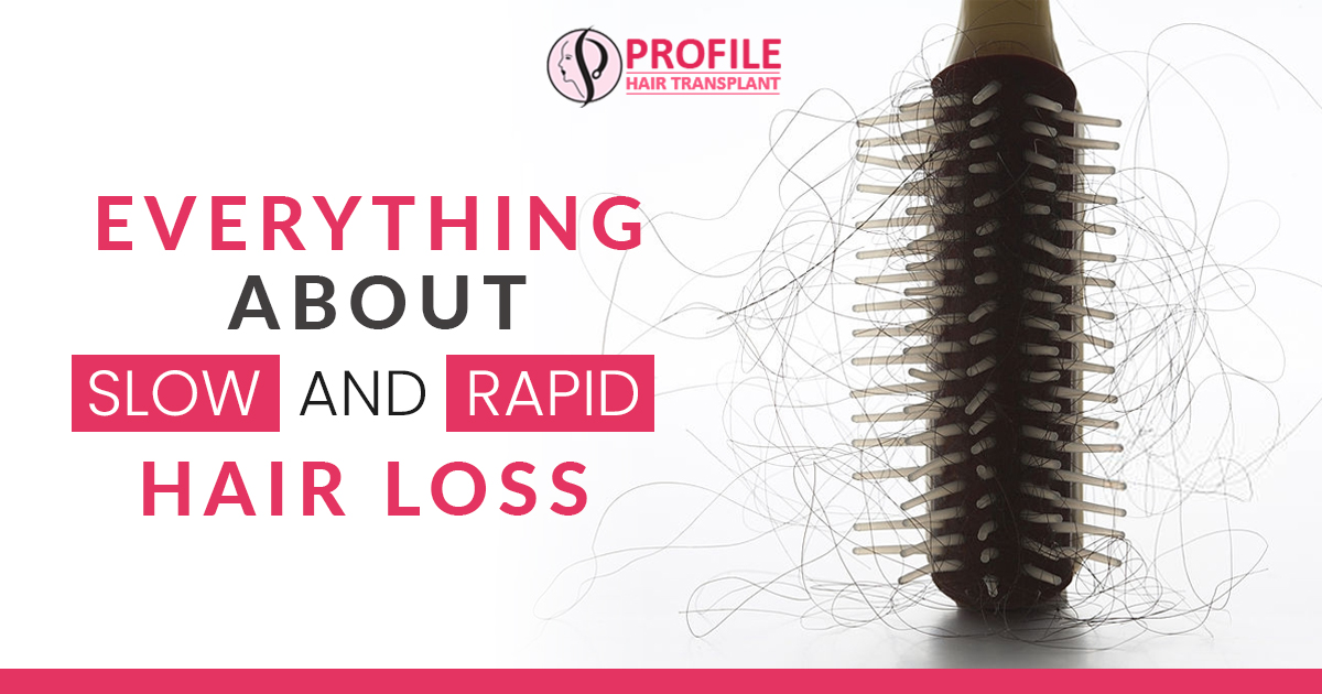 Everything about Slow and Rapid Hair Loss