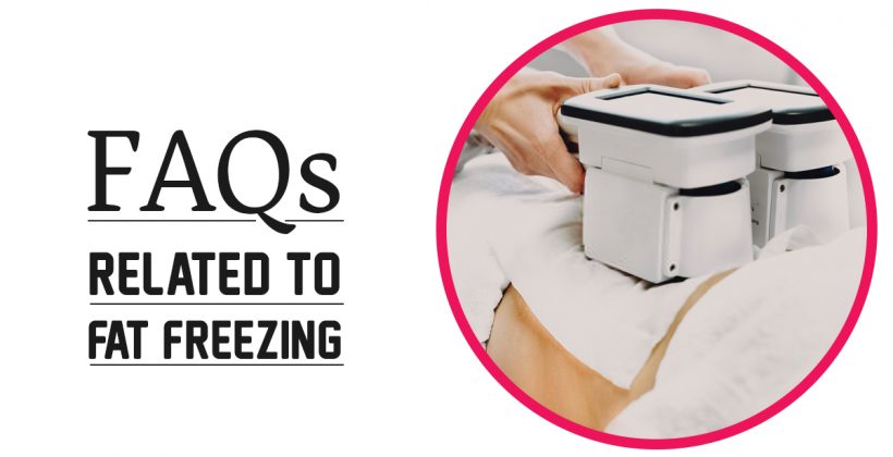 FAQs Related To Fat Freezing