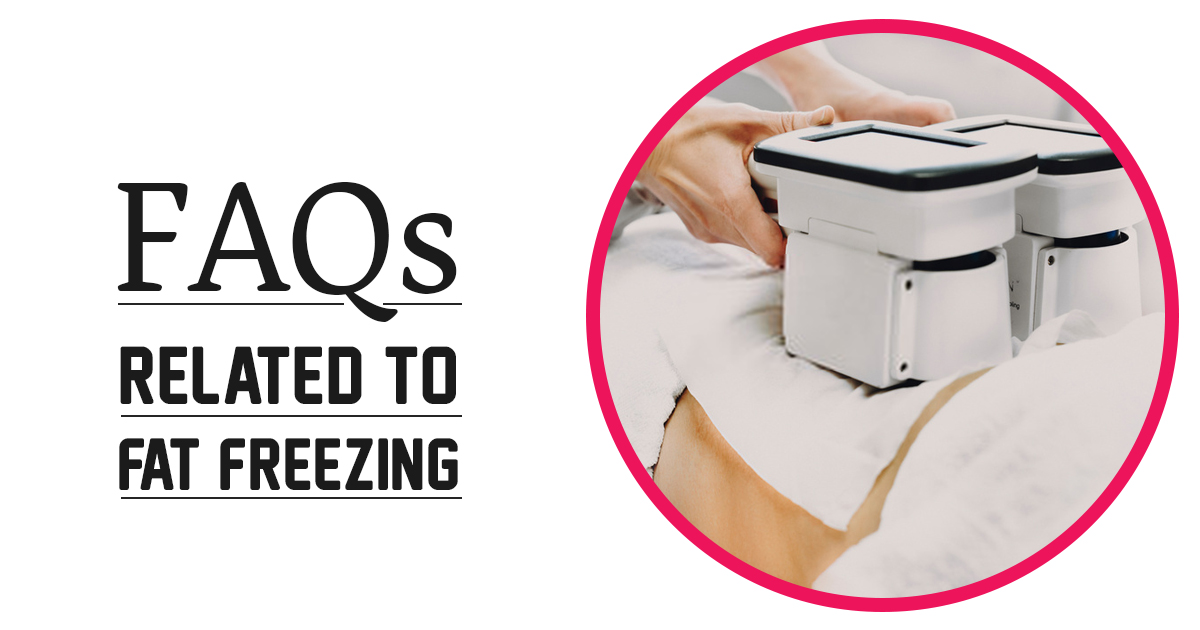 FAQs Related To Fat Freezing