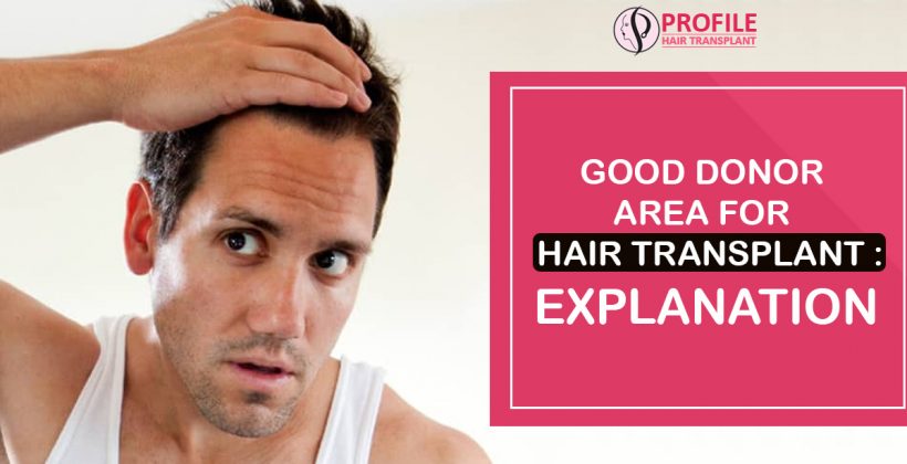 Good Donor Area for Hair Transplant : Explanation