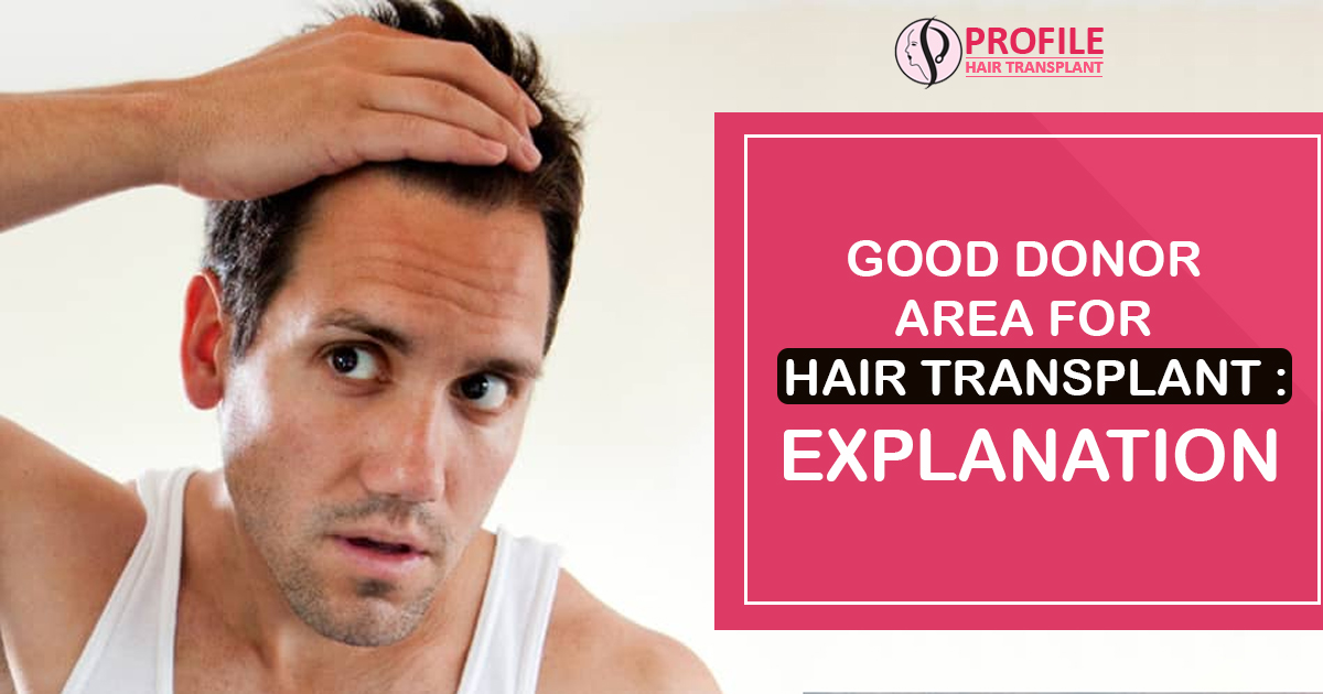 Good Donor Area for Hair Transplant : Explanation