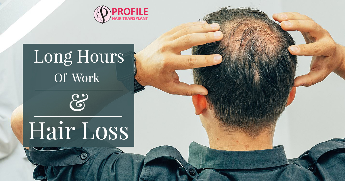 Long Hours of Work and Hair Loss