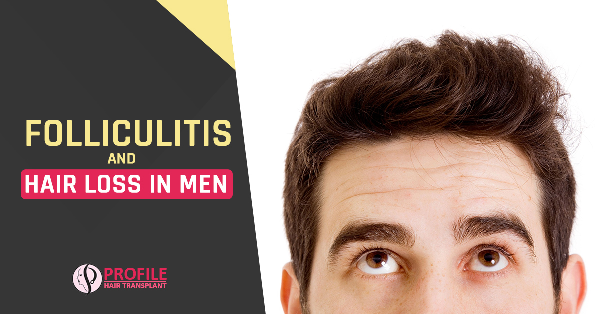 Folliculitis and Hair Loss in Men
