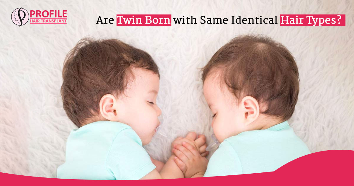 Are Twin Born with the same hair types?