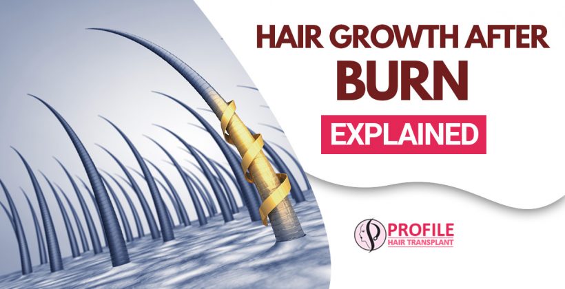 Hair Growth After Burn : Explained