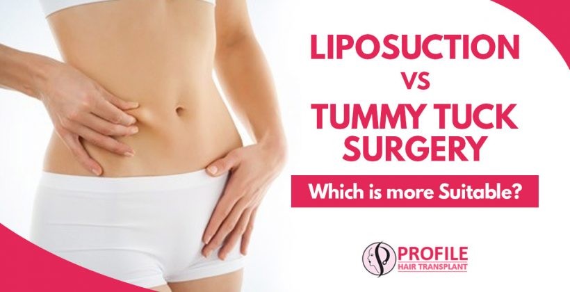 Liposuction vs Tummy Tuck surgery : Which is more suitable?