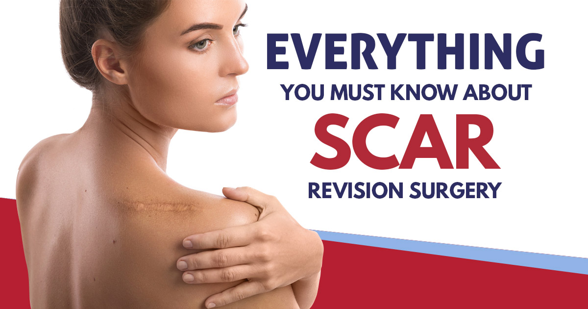 Everything you Must know about Scar Revision Surgery