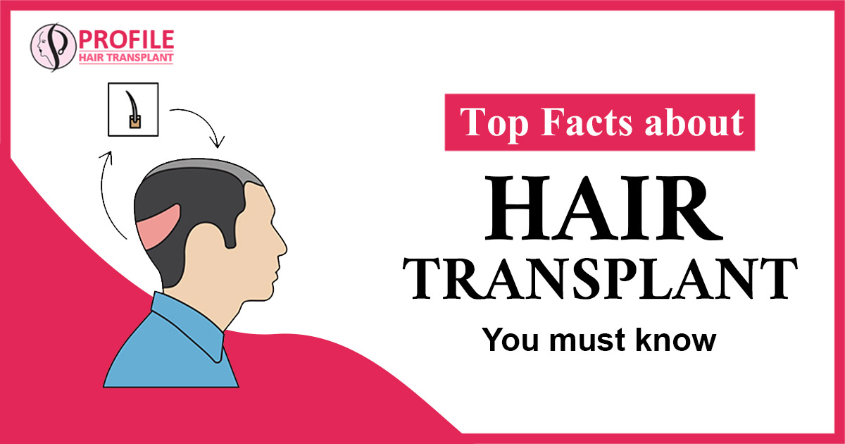 Case Study of one of our patients who underwent hair transplant surgery.