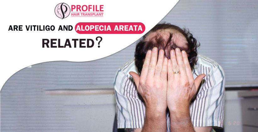 Are vitiligo and alopecia areata Related?