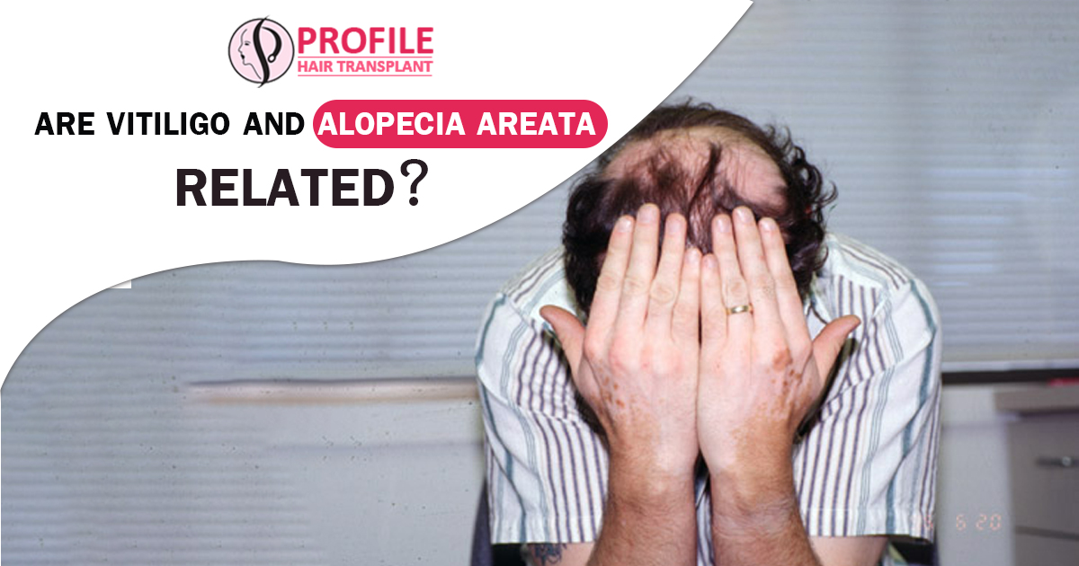 Are vitiligo and alopecia areata Related?