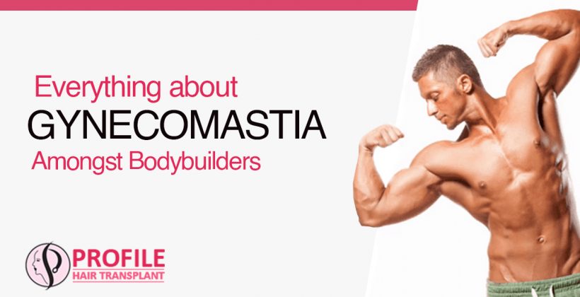 Everything about Gynecomastia Amongst Bodybuilders
