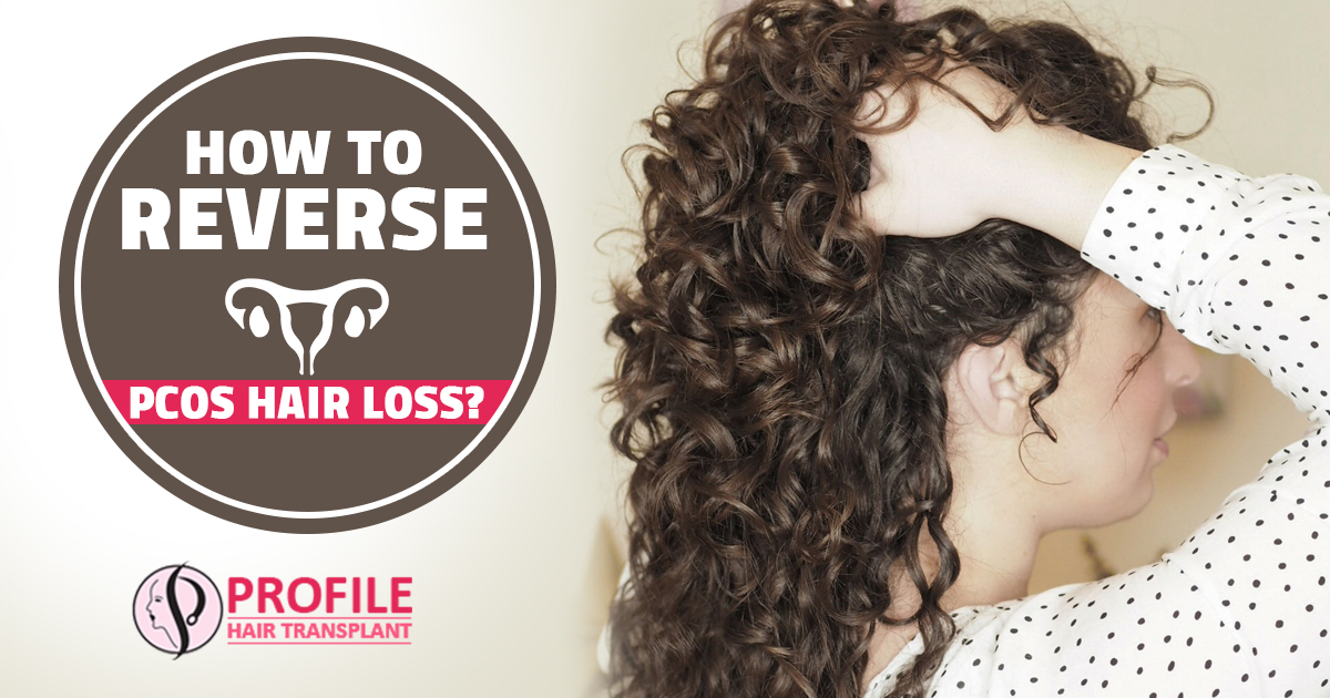Some people with polycystic ovary syndrome can experience hair loss. Find  out more about why this can happen by checking out the link in… | Instagram