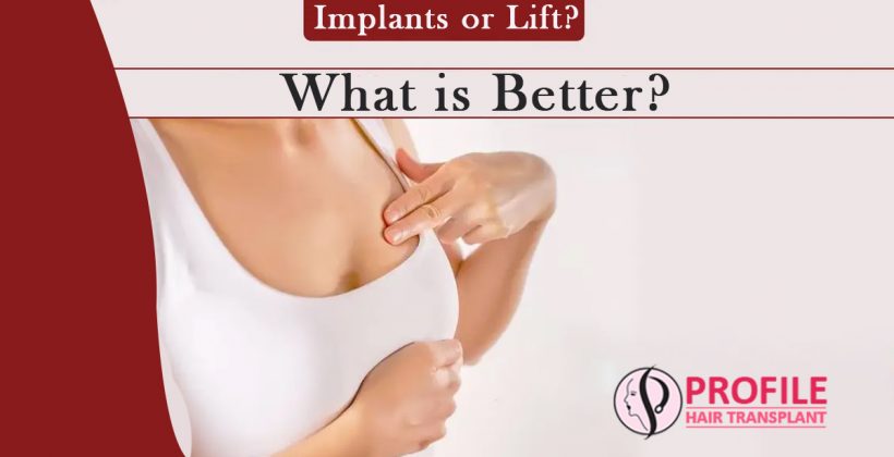 Implants or Lift? What is Better?