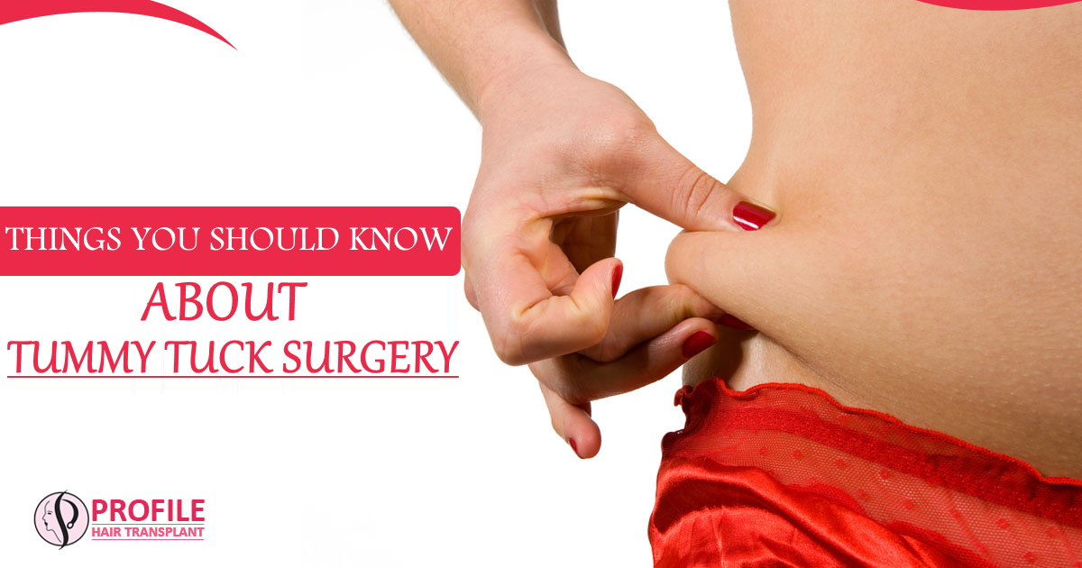 Things you Should know about Tummy Tuck Surgery