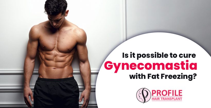 Is it possible to cure Gynecomastia with Fat Freezing?