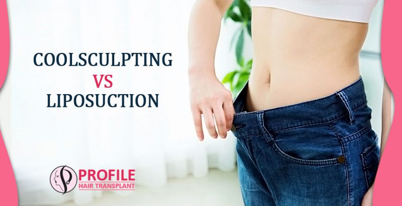 Explain the difference between Liposuction and CoolsSculpting treatment?