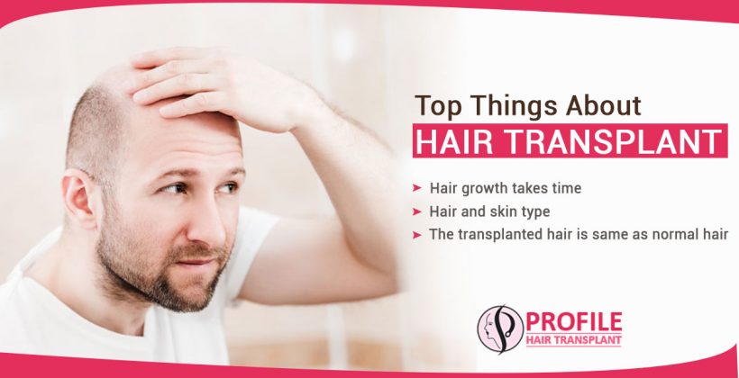What are the topmost things which you need to know about hair transplant?
