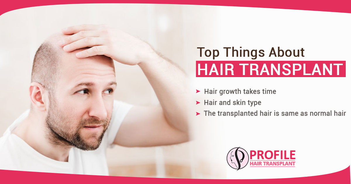 What are the topmost things which you need to know about hair transplant?