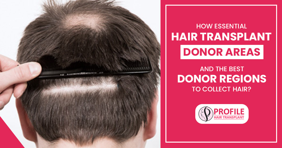 How essential Hair Transplant Donor Areas and the best donor regions to collect hair?