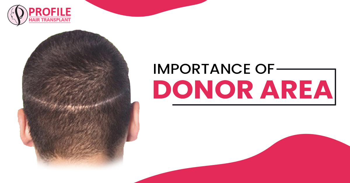 Why is it important to use the donor area during hair transplant treatment?