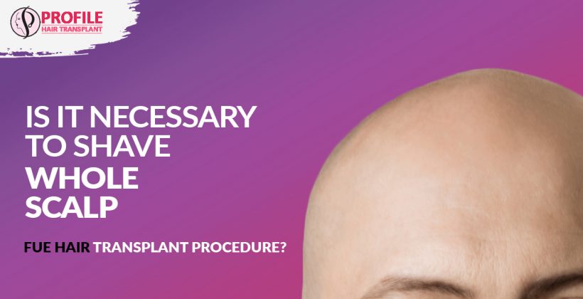 Is it necessary to shave the whole scalp before undergoing an FUE hair transplant procedure?