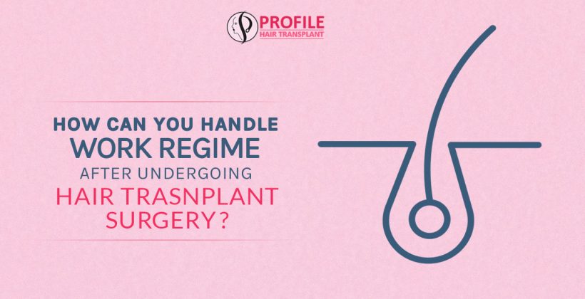 How can you handle the work regime after undergoing hair transplant surgery?