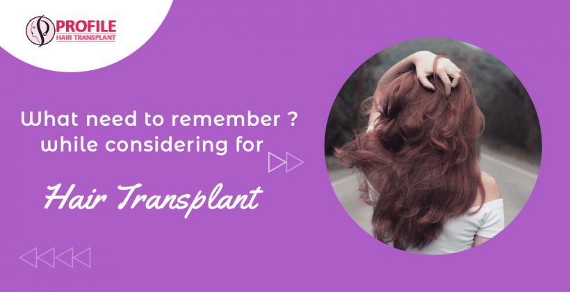 What are the things that you need to remember while considering for Hair Transplant?