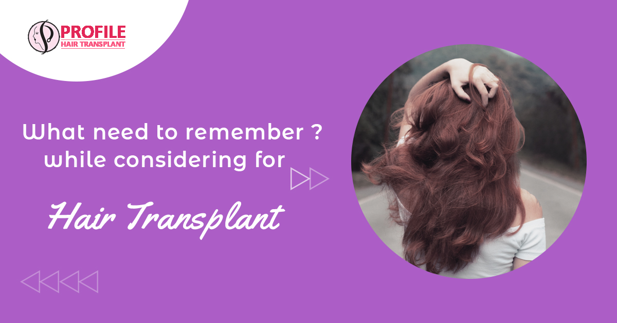 What are the things that you need to remember while considering for Hair Transplant?