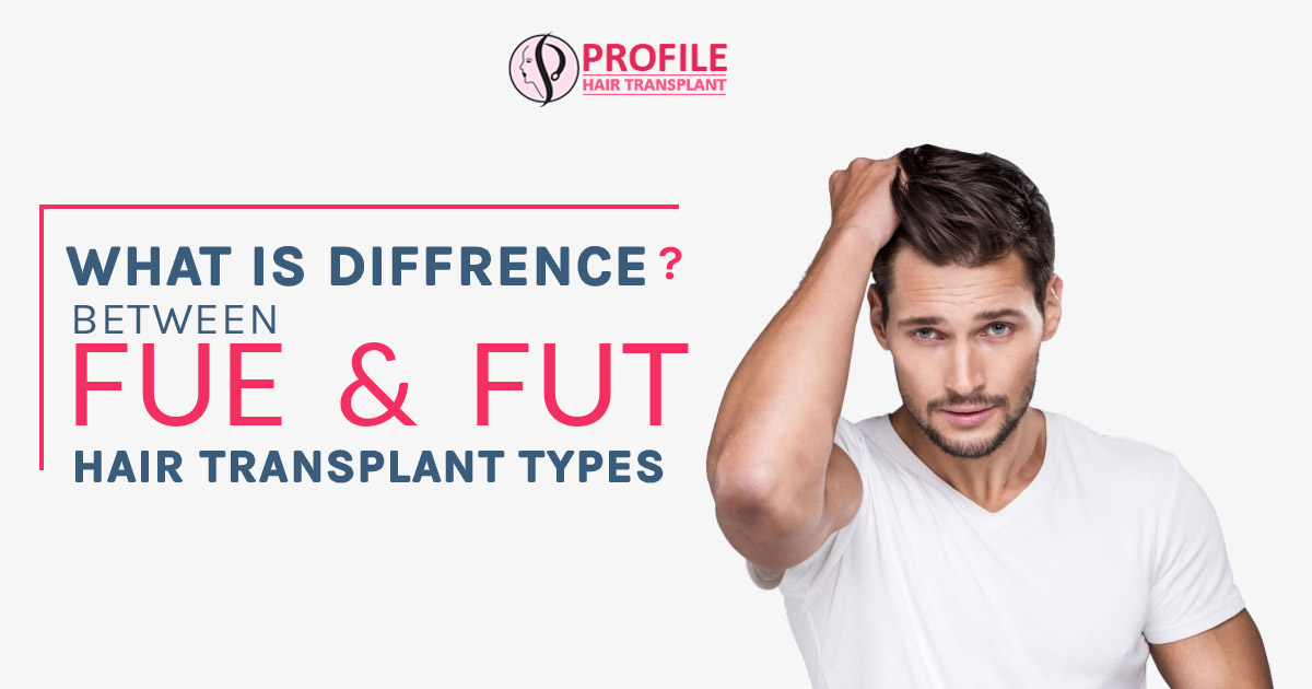 What is the difference between FUE and FUT hair transplant types?