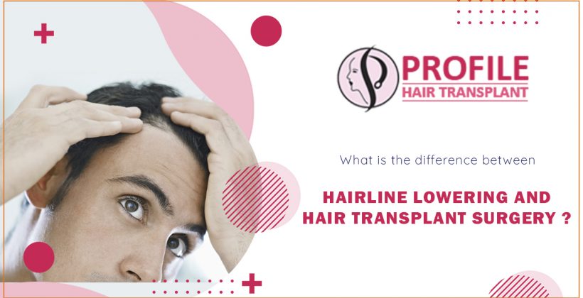 What is the difference between hairline lowering and hair transplant surgery?