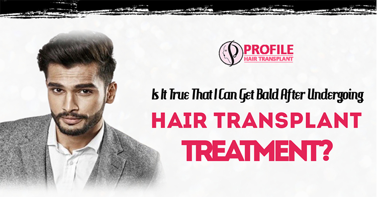 Is it true that I can get bald after undergoing hair transplant treatment?