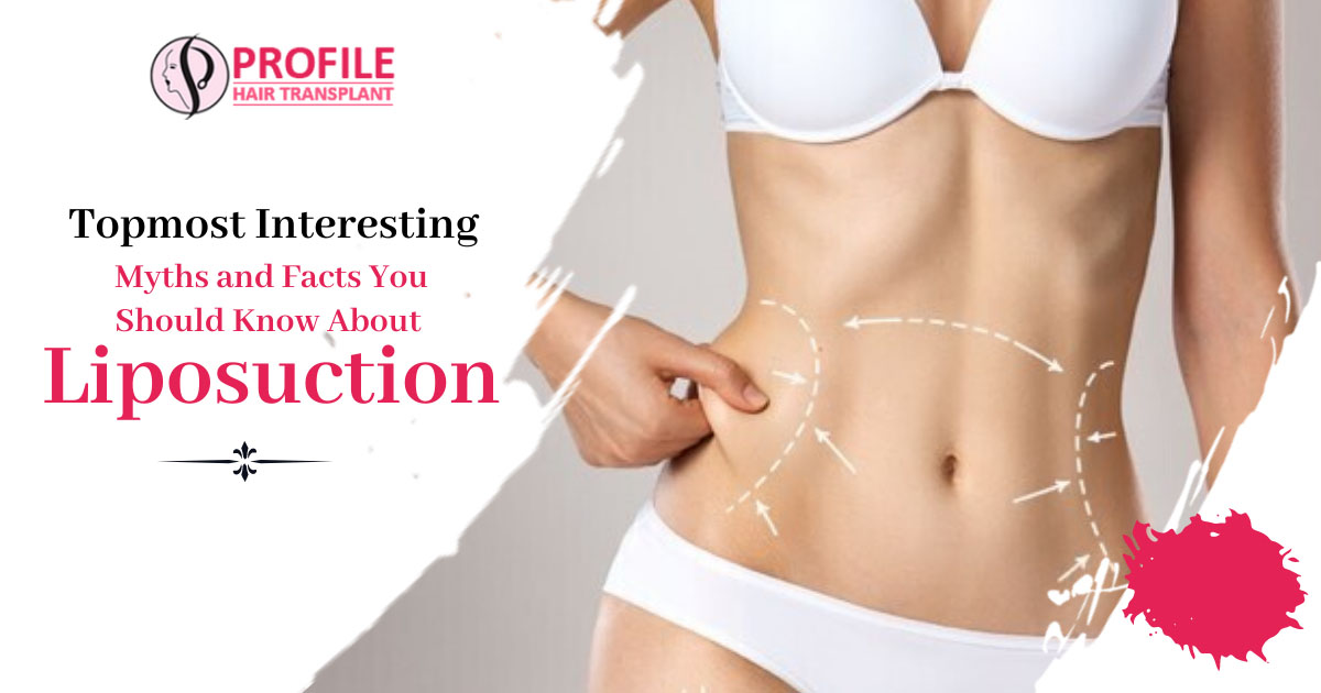 Topmost interesting myths and facts you should know about Liposuction
