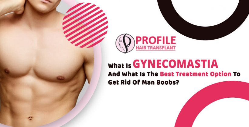 What is gynecomastia and what is the best treatment option to get rid of man boobs?