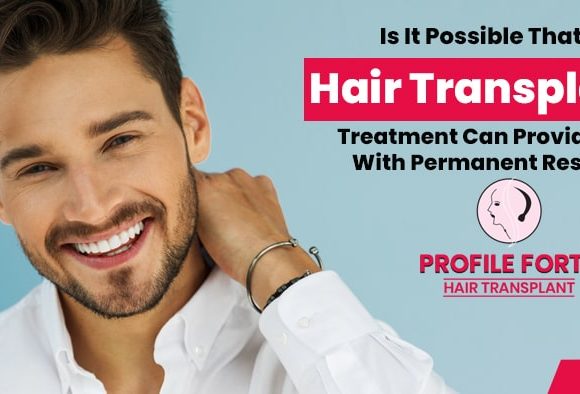 Hair Restoration Doctor Guide: Does hair transplant give permanent results?