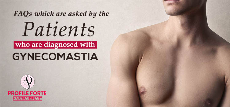 FAQs which are asked by the patients who are diagnosed with gynecomastia