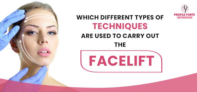 Which different types of techniques are used to carry out the facelift?
