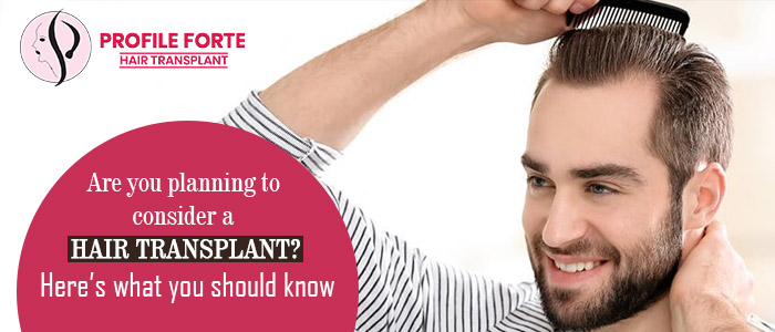 Are you planning to consider a hair transplant? Here’s what you should know