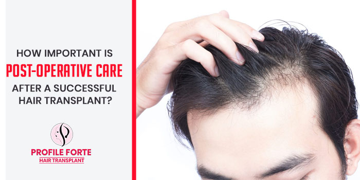 How important is post-operative care after a successful hair transplant?