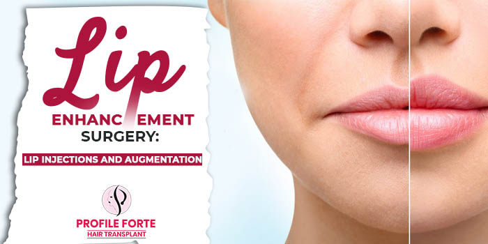 Lip Enhancement Surgery Lip Injections and Augmentation