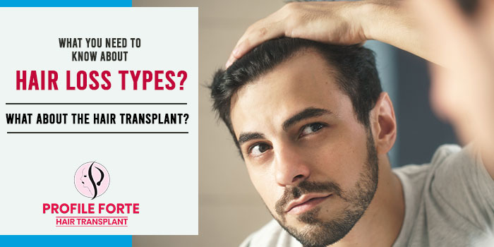 What do you need to know about hair loss types? What about the hair transplant?
