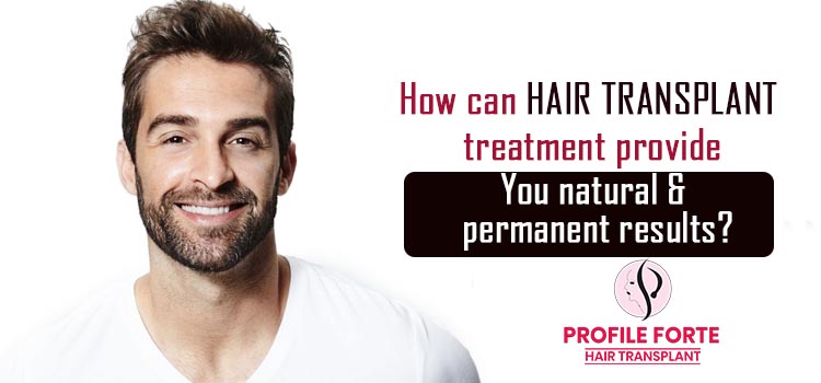 How can hair transplant treatment provide you natural and permanent results?